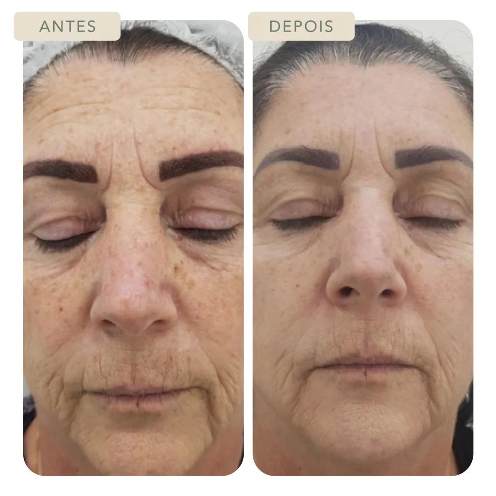 Skinbooster